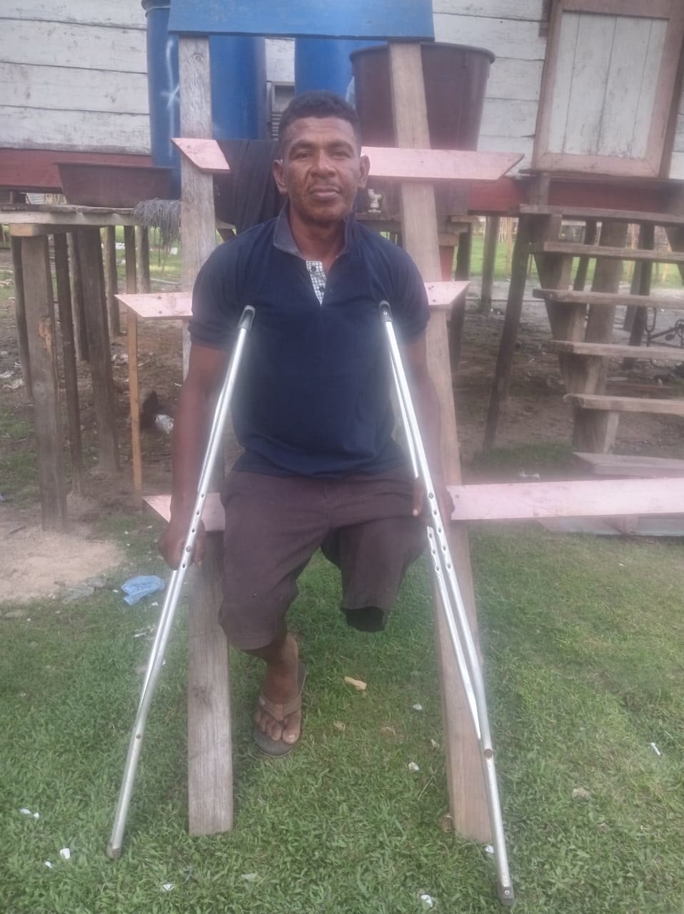Hombre con muletas en el municipio de Villeda Morales